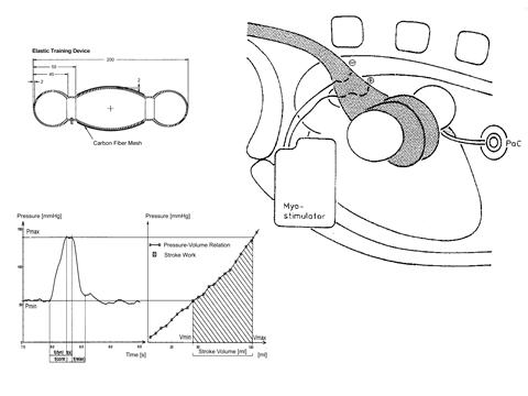 Prinzip der Schlagvolumen und Schlagenergiebestimmung